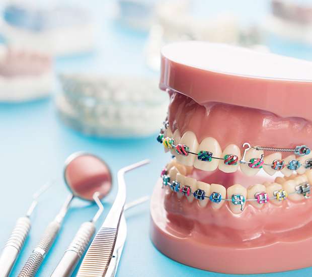 Laguna Hills Orthodontist