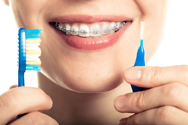 The Pros and Cons of Ceramic Braces - Orange Coast Orthodontics