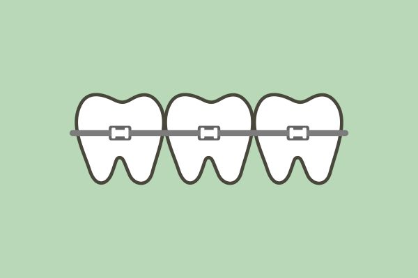 What Are The Benefits Of Getting Braces?
