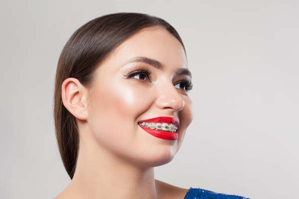 Popular Cosmetic Orthodontic Treatments